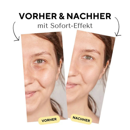 Augenpads vorher nachher beispiel